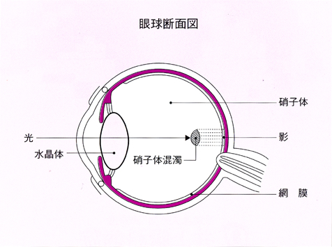 眼球断面図